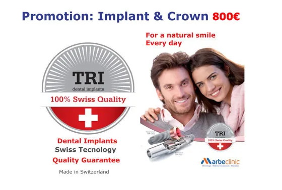 Dental Implants Marbella